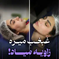 لیپوساکشن غبغب با ویزر و اندولیفت توسط جراح تضمینی|خدمات آرایشگری و زیبایی|مشهد, راهنمایی|دیوار