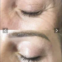 بیوممتیک روشن کننده وضد لک اصل ایتالیا