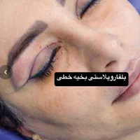 افتادگی پلک،بلفاروپلاستی،سانترال لب،بوکال فت،غبغب|خدمات آرایشگری و زیبایی|تهران, پاسداران|دیوار