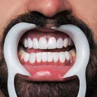 دندان‌پزشکی.لمینت.کامپوزیت|خدمات آرایشگری و زیبایی|تهران, زرکش|دیوار