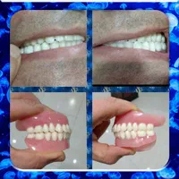 ساخت دندان مصنوعی باکیفیت وضمانت|خدمات آرایشگری و زیبایی|نهاوند, |دیوار