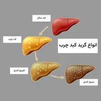 بهبود کبد چرب