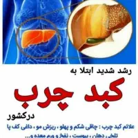 کبدچرب