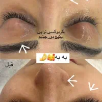 آموزش فیشال تخصصی،مزونیدلینگ،کربوکسی و..