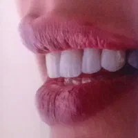 دندان پزشکی و زیبایی