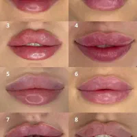 جشنواره آموزشی فیلر نخ بوتاکس زیر نظر دکتر...|خدمات آموزشی|تهران, قلهک|دیوار