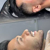 جشنواره ژل لب روسی فیلرزاویه بوتاکس مزو لیزرفیشیال|خدمات آرایشگری و زیبایی|شهریار, شهریار|دیوار