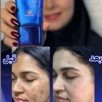 زیبایی صورت