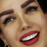 کامپوزیت دندان