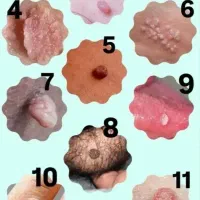 آزمایش منفی  زگیل hpv با محصولات کاملا گیاهی