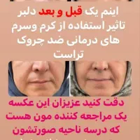 مشاور پوست و مو لیاتیم|آرایشی، بهداشتی، درمانی|اصفهان, باغ زرشک|دیوار