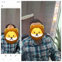 گریم داماد و کاشت موقت مو