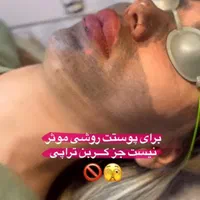 ریموو تاتو/ریزش سکه ای/مزوتـراپی/خال بـرداری/فیشال|خدمات آرایشگری و زیبایی|شیراز, طلاب|دیوار