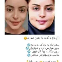 کرم معجزه روشن کننده قوی ضدلک جوش وتیرگی ضمانتی|آرایشی، بهداشتی، درمانی|سرپل ذهاب, |دیوار