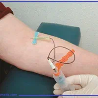 حجامت زالو طب سوزنی فصد امبدینگ رفع گرفتگی|خدمات آرایشگری و زیبایی|اصفهان, شیخ اشراق|دیوار