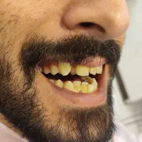 دندان پزشکی|خدمات آرایشگری و زیبایی|رشت, گلسار|دیوار