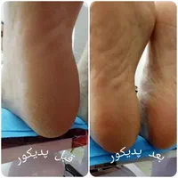 پدیکور تخصصی  و فشیال فردیس
