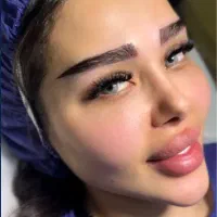 تخفیف کاشت ابرو۱۳ تومن بلفارو(۹تومن)غبغب ۷