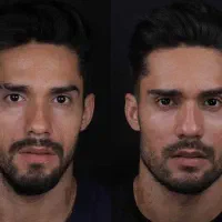 ویژه اقایان آف بوتاکس فیلر و پاکسازی|خدمات آرایشگری و زیبایی|کرج, گلشهر|دیوار