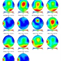 بدون قرص اعصاب درمان شو با دستگاه لورتا/ روانشناسی