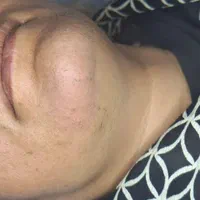 لیزر والکترولیز|خدمات آرایشگری و زیبایی|شیراز, شاه قلی بیگی|دیوار