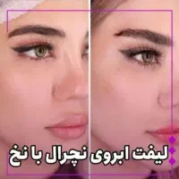 پی آر پی (prp) بایوفیلر اگزوزوم ژل فیلربادی بوتاکس|خدمات آرایشگری و زیبایی|کرج, گوهردشت|دیوار