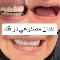 دندان مصنوعی با کیفیت و تخصصی در همدان با بیمه|خدمات آرایشگری و زیبایی|همدان, |دیوار