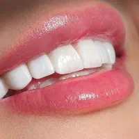دندانپزشکی اقساطی / کامپوزیت لمینت / عصب‌کشی
