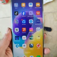آنر x9b