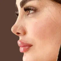 عمل بینی و لیپو+ابدو- اقساط