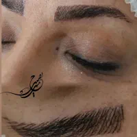 فیبروز ابرو