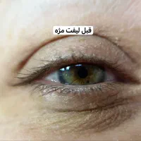 تخفیف ویژه لیفت ابرو و مژه|خدمات آرایشگری و زیبایی|رشت, استادسرا|دیوار