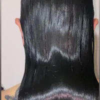 ۵نفر به قید قرعه پیشم ترمیم رایگان انجام میدن