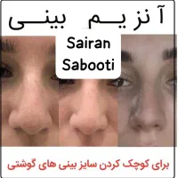 آنزیم بینی گوشتی غبغب پلاسما تراپی|خدمات آرایشگری و زیبایی|شیراز, محراب|دیوار