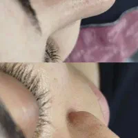 فشیال وپاکسازی تخصصی