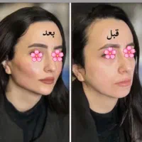 تخفیف ویژه کلینیک زیبایی لوکس و مجهز در نسیم شهر|خدمات آرایشگری و زیبایی|نسیم‌شهر, |دیوار