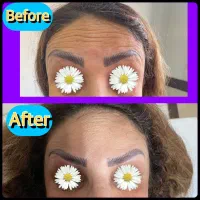 بوتاکس/پی آر پی/ژل لب/لیزر /مسکن|خدمات آرایشگری و زیبایی|کرمانشاه, |دیوار