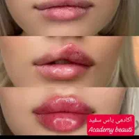 آموزش نخ پیارپی بایو فیلر ژل بادی با مدرک