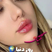 تزریق ژل لب بوتاکس فیلر بادی انزیم لیفت زاویه مزو