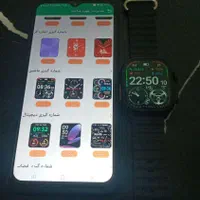 ساعت هوشمند اپل واچ