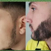 اینو بمال به صورتت معجزشو میبینی