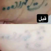 لیزر موهای زائد میکروسویچ و اپلومد کندلا وایتنینگ|خدمات آرایشگری و زیبایی|اصفهان, طامه|دیوار