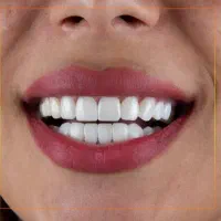 خدمات دندانپزشکی با شرایط ویژه