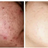 کرم معجزه شب اصل رفع لک وجوش وسفیدشدن پوست|آرایشی، بهداشتی، درمانی|قم, چهار مردان|دیوار