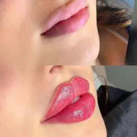 آموزش ژل فیلر لب چانه انزیم چاقی صورت مزو مو فشیال|خدمات آرایشگری و زیبایی|قم, زنبیل آباد|دیوار