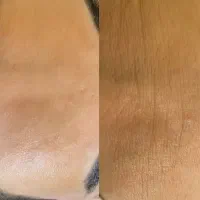 بهترین ترکیبات جوان سازی پوست