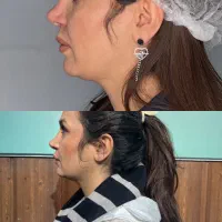 تخلیه غب غب|خدمات آرایشگری و زیبایی|خرم‌آباد, |دیوار