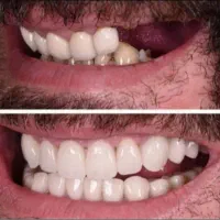 کلیه خدمات دندانپزشکی مناسب همه|خدمات آرایشگری و زیبایی|کرمانشاه, |دیوار