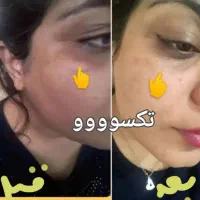 درمان مشکلات بدنی|آرایشی، بهداشتی، درمانی|سیرجان, |دیوار