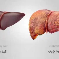 درمانی